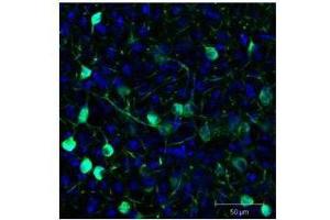 Immunofluorescence (IF) image for anti-Green Fluorescent Protein (GFP) antibody (ABIN100085)