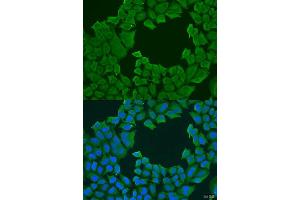 Immunofluorescence analysis of U2OS cells using STXBP3 antibody. (STXBP3 antibody  (AA 343-592))