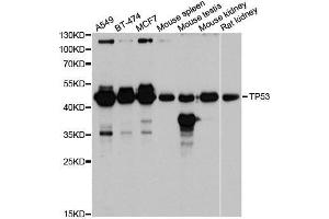 Western blot analysis of extracts of various cell lines, using TP53 antibody. (p53 antibody  (AA 1-100))