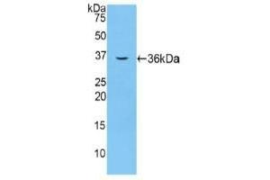 Detection of Recombinant F5, Mouse using Polyclonal Antibody to Coagulation Factor V (F5)