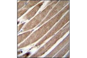 Formalin Fixed, Paraffin Embedded Human skeletal muscle stained with ATG4D Antibody (N-term) followed by peroxidase conjugation to the secondary antibody and DAB staining. (ATG4D antibody  (N-Term))