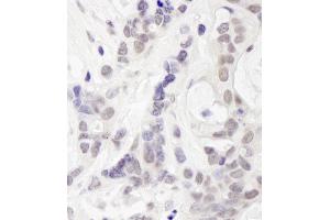 Immunohistochemistry (IHC) image for anti-Ubiquitin Interaction Motif Containing 1 (UIMC1) (C-Term) antibody (ABIN7449010) (UIMC1 antibody  (C-Term))