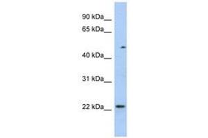 Image no. 1 for anti-Transcription Elongation Factor A (SII)-Like 3 (TCEAL3) (N-Term) antibody (ABIN6743568) (TCEAL3 antibody  (N-Term))