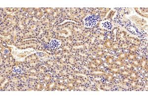 Detection of C3 Convertase in Mouse Kidney Tissue using Polyclonal Antibody to Complement C3 Convertase (C3 Convertase) (Complement C3 Convertase antibody)