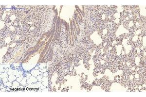 Immunohistochemistry (IHC) image for anti-Collagen, Type IV, alpha 1 (COL4A1) antibody (ABIN5959046) (COL4A1 antibody)