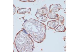 Immunohistochemistry of paraffin-embedded human placenta using LRP1 antibody (ABIN3021968, ABIN3021969, ABIN3021970 and ABIN6218530) at dilution of 1:100 (40x lens).