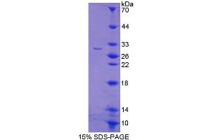 SDS-PAGE analysis of Rat ABCC6 Protein. (ABCC6 Protein)