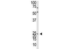 Image no. 1 for anti-Neurogenin 2 (NEUROG2) (C-Term) antibody (ABIN357410) (Neurogenin 2 antibody  (C-Term))