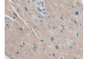 DAB staining on IHC-P; Samples: Rat Heart Tissue (RSPO1 antibody  (AA 21-135))