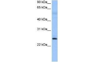 ROPN1B antibody used at 0. (ROPN1B antibody  (N-Term))