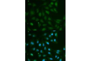 Immunofluorescence analysis of MCF7 cell using ABO antibody. (ABO antibody  (AA 54-354))