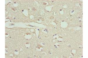 Immunohistochemistry of paraffin-embedded human brain tissue using ABIN7146563 at dilution of 1:100 (Calreticulin antibody  (AA 18-415))