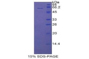 SDS-PAGE (SDS) image for CD5 Molecule-Like (CD5L) (AA 11-346) protein (His tag,GST tag) (ABIN1877855) (CD5L Protein (AA 11-346) (His tag,GST tag))