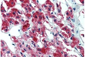 Adrenal, Human: Formalin-Fixed, Paraffin-Embedded (FFPE) (IL23A antibody)