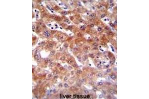 Immunohistochemistry (IHC) image for anti-Cytochrome P450, Family 1, Subfamily A, Polypeptide 2 (CYP1A2) antibody (ABIN2996139)