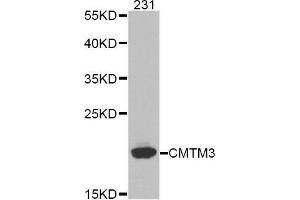 Western blot analysis of extracts of 231 cell line, using CMTM3 antibody. (CMTM3 antibody)