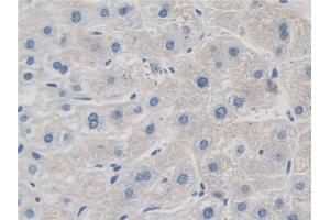 IHC-P analysis of Human Liver Tissue, with DAB staining. (GRK4 antibody  (AA 187-449))