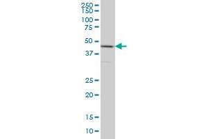HNRNPG-T monoclonal antibody (M01), clone 6F11 Western Blot analysis of HNRNPG-T expression in HeLa . (RBMXL2 antibody  (AA 1-90))