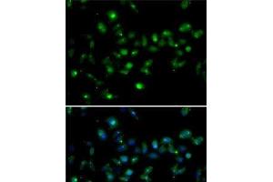 Immunofluorescence analysis of MCF7 cells using MORF4L1 Polyclonal Antibody (MORF4L1 antibody)