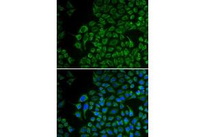 Immunofluorescence (IF) image for anti-Tyrosinase (TYR) (AA 20-340) antibody (ABIN3021852)