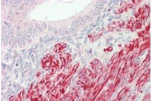 Human Uterus: Formalin-Fixed, Paraffin-Embedded (FFPE) (INPP5K antibody  (AA 183-430))