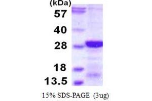 SDS-PAGE (SDS) image for Regulator of Calcineurin 2 (RCAN2) (AA 1-197) protein (His tag) (ABIN667616)