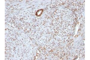 Formalin-fixed, paraffin-embedded human Uterus stained with Nucleolin Monoclonal Antibody (364-5 + NCL/902). (Nucleolin antibody)