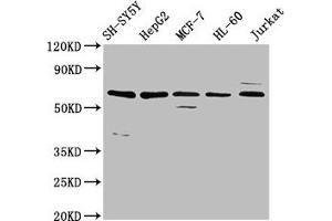 Western Blot Positive WB detected in: SH-SY5Y whole cell lysate, HepG2 whole cell lysate, MCF-7 whole cell lysate, HL-60 whole cell lysate, Jurkat whole cell lysate All lanes: HRG antibody at 4. (HRG antibody  (AA 412-511))