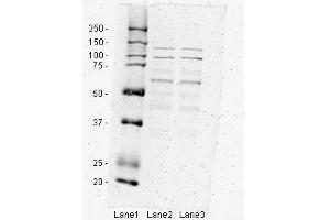 Western Blotting (WB) image for anti-Inhibitor of kappa Light Polypeptide Gene Enhancer in B-Cells, Kinase beta (IKBKB) (N-Term) antibody (ABIN2779787)