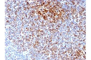 Immunohistochemistry (IHC) image for anti-B-Cell CLL/lymphoma 2 (BCL2) antibody (ABIN6940502)