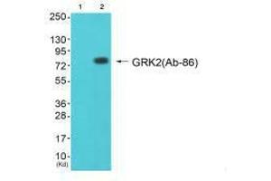 Western blot analysis of extracts from cos-7 cells (Lane 2), using GRK2 (Ab-86) antiobdy. (GRK2 antibody  (N-Term))