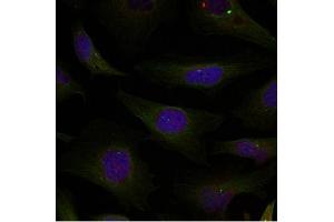 Image no. 2 for anti-HDAC4,HDAC5,HDAC9 (Ser220), (Ser246), (Ser259) antibody (ABIN319390) (HDAC4/HDAC5/HDAC9 antibody  (Ser220, Ser246, Ser259))