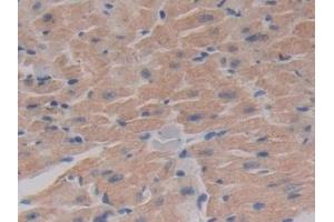 Detection of PDHX in Mouse Heart Tissue using Polyclonal Antibody to Pyruvate Dehydrogenase Complex Component X (PDHX) (PDHX antibody  (AA 222-471))