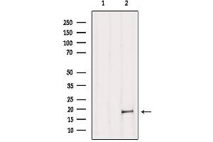 Western blot analysis of extracts from B16F10, using MAX Antibody. (MAX antibody  (N-Term))