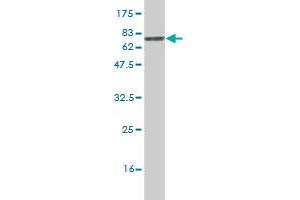 Western Blot detection against Immunogen (70. (PHKG2 antibody  (AA 1-406))