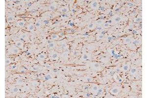 ABIN6272737 at 1/200 staining Rat brain tissue sections by IHC-P. (P2RY12 antibody  (N-Term))