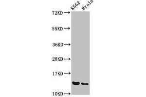 Western Blot Positive WB detected in: K562 whole cell lysate, Rat brain tissue All lanes: BET1 antibody at 3.
