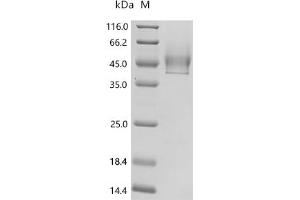 Syndecan 1 (SDC1) (AA 23-254) (Active) protein (His tag)