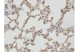 Immunohistochemistry (IHC) image for anti-thromboxane A Synthase 1 (Platelet) (TBXAS1) antibody (ABIN1875427) (TBXAS1 antibody)