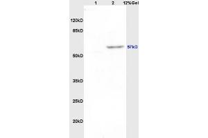 Lane 1: rat brain lysates Lane 2: rat brain lysates probed with Anti Pancreatic Amylase Polyclonal Antibody, Unconjugated (ABIN752788) at 1:200 in 4 °C. (Pancreatic Amylase antibody  (AA 151-250))