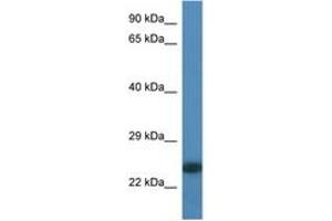 Image no. 1 for anti-Myosin, Light Chain 6B, Alkali, Smooth Muscle and Non-Muscle (MYL6B) (N-Term) antibody (ABIN6746337) (MYL6B antibody  (N-Term))