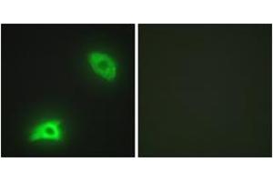 Immunofluorescence analysis of HeLa cells, using DUSP6 Antibody. (DUSP6 antibody  (AA 61-110))