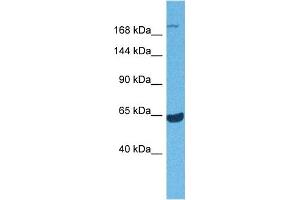 Host:  Rabbit  Target Name:  ABCA7  Sample Tissue:  Mouse Spleen  Antibody Dilution:  1ug/ml (ABCA7 antibody  (Middle Region))