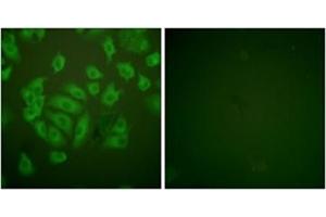 Immunofluorescence analysis of A549 cells, using Stefin A Antibody . (CSTA antibody  (Internal Region))
