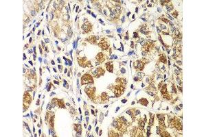 Immunohistochemistry of paraffin-embedded Human gastric using RAC1 Polyclonal Antibody at dilution of 1:100 (40x lens).