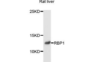 Western blot analysis of extracts of rat liver, using RBP1 antibody (ABIN6003736) at 1/1000 dilution. (RBP1 antibody)