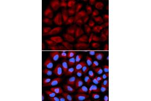 Immunofluorescence analysis of U2OS cell using FANCC antibody. (FANCC antibody)