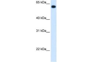 Western Blotting (WB) image for anti-Aldehyde Dehydrogenase 4 Family, Member A1 (ALDH4A1) antibody (ABIN2462884) (ALDH4A1 antibody)
