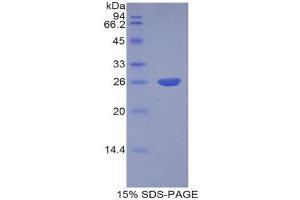 SDS-PAGE (SDS) image for Cathepsin S (CTSS) (AA 115-331) protein (His tag) (ABIN1877859) (Cathepsin S Protein (CTSS) (AA 115-331) (His tag))