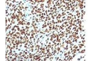 IHC testing of FFPE human tonsil with Nuclear Antigen antibody. (Nuclear Antigen antibody)